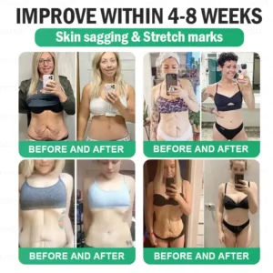 𝑫𝑶𝑻𝑨𝑳𝑬® 𝑵𝑨𝑫+ 𝑴𝒐𝒓𝒊𝒏𝒈𝒂 𝑩𝒆𝒓𝒃𝒆𝒓𝒊𝒏𝒆 𝑨𝑴𝑷𝑲 𝑺𝒖𝒑𝒑𝒐𝒓𝒕 𝑵𝒂𝒏𝒐 𝑴𝒊𝒄𝒓𝒐𝒏𝒆𝒆𝒅𝒍𝒆 𝑷𝒂𝒕𝒄𝒉 (𝐉𝐮𝐬𝐭 𝐨𝐧𝐜𝐞 𝐚 𝐝𝐚𝐲, 𝐯𝐢𝐬𝐢𝐛𝐥𝐞 𝐜𝐡𝐚𝐧𝐠𝐞𝐬 𝐢𝐧 𝟕 𝐝𝐚𝐲𝐬）𝙁𝙤𝙧𝙢𝙪𝙡𝙖 ✅ 𝐅𝐨𝐫 𝑺𝒖𝒑𝒑𝒐𝒓𝒕𝒔 𝑴𝒆𝒕𝒂𝒃𝒐𝒍𝒊𝒔𝒎, 𝑾𝒆𝒊𝒈𝒉𝒕 𝑴𝒂𝒏𝒂𝒈𝒆𝒎𝒆𝒏𝒕, 𝑯𝒆𝒂𝒓𝒕 𝑯𝒆𝒂𝒍𝒕𝒉,𝐨𝐛𝐞𝐬𝐢𝐭𝐲, 𝗟𝗼𝗼𝘀𝗲 𝘀𝗸𝗶𝗻,𝐝𝐢𝐚𝐛𝐞𝐭𝐞𝐬, 𝐬𝐥𝐞𝐞𝐩 𝐚𝐩𝐧𝐞𝐚, 𝐣𝐨𝐢𝐧𝐭 𝐢𝐬𝐬𝐮𝐞𝐬, 𝐚𝐧𝐝 𝐦𝐨𝐫𝐞