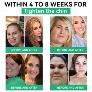 𝑫𝑶𝑻𝑨𝑳𝑬® 𝑵𝑨𝑫+ 𝑴𝒐𝒓𝒊𝒏𝒈𝒂 𝑩𝒆𝒓𝒃𝒆𝒓𝒊𝒏𝒆 𝑨𝑴𝑷𝑲 𝑺𝒖𝒑𝒑𝒐𝒓𝒕 𝑵𝒂𝒏𝒐 𝑴𝒊𝒄𝒓𝒐𝒏𝒆𝒆𝒅𝒍𝒆 𝑷𝒂𝒕𝒄𝒉🇺🇸 (𝐉𝐮𝐬𝐭 𝐨𝐧𝐜𝐞 𝐚 𝐝𝐚𝐲, 𝐯𝐢𝐬𝐢𝐛𝐥𝐞 𝐜𝐡𝐚𝐧𝐠𝐞𝐬 𝐢𝐧 𝟕 𝐝𝐚𝐲𝐬）𝙁𝙤𝙧𝙢𝙪𝙡𝙖 ✅ 𝐅𝐨𝐫 𝑺𝒖𝒑𝒑𝒐𝒓𝒕𝒔 𝑴𝒆𝒕𝒂𝒃𝒐𝒍𝒊𝒔𝒎, 𝑾𝒆𝒊𝒈𝒉𝒕 𝑴𝒂𝒏𝒂𝒈𝒆𝒎𝒆𝒏𝒕, 𝑯𝒆𝒂𝒓𝒕 𝑯𝒆𝒂𝒍𝒕𝒉,𝐨𝐛𝐞𝐬𝐢𝐭𝐲, 𝗟𝗼𝗼𝘀𝗲 𝘀𝗸𝗶𝗻,𝐝𝐢𝐚𝐛𝐞𝐭𝐞𝐬, 𝐬𝐥𝐞𝐞𝐩 𝐚𝐩𝐧𝐞𝐚, 𝐣𝐨𝐢𝐧𝐭 𝐢𝐬𝐬𝐮𝐞𝐬, 𝐚𝐧𝐝 𝐦𝐨𝐫𝐞 (Copy)