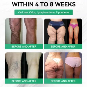 𝑫𝑶𝑻𝑨𝑳𝑬® 𝑵𝑨𝑫+ 𝑴𝒐𝒓𝒊𝒏𝒈𝒂 𝑩𝒆𝒓𝒃𝒆𝒓𝒊𝒏𝒆 𝑨𝑴𝑷𝑲 𝑺𝒖𝒑𝒑𝒐𝒓𝒕 𝑵𝒂𝒏𝒐 𝑴𝒊𝒄𝒓𝒐𝒏𝒆𝒆𝒅𝒍𝒆 𝑷𝒂𝒕𝒄𝒉🇺🇸 (𝐉𝐮𝐬𝐭 𝐨𝐧𝐜𝐞 𝐚 𝐝𝐚𝐲, 𝐯𝐢𝐬𝐢𝐛𝐥𝐞 𝐜𝐡𝐚𝐧𝐠𝐞𝐬 𝐢𝐧 𝟕 𝐝𝐚𝐲𝐬）𝙁𝙤𝙧𝙢𝙪𝙡𝙖 ✅ 𝐅𝐨𝐫 𝑺𝒖𝒑𝒑𝒐𝒓𝒕𝒔 𝑴𝒆𝒕𝒂𝒃𝒐𝒍𝒊𝒔𝒎, 𝑾𝒆𝒊𝒈𝒉𝒕 𝑴𝒂𝒏𝒂𝒈𝒆𝒎𝒆𝒏𝒕, 𝑯𝒆𝒂𝒓𝒕 𝑯𝒆𝒂𝒍𝒕𝒉,𝐨𝐛𝐞𝐬𝐢𝐭𝐲, 𝗟𝗼𝗼𝘀𝗲 𝘀𝗸𝗶𝗻,𝐝𝐢𝐚𝐛𝐞𝐭𝐞𝐬, 𝐬𝐥𝐞𝐞𝐩 𝐚𝐩𝐧𝐞𝐚, 𝐣𝐨𝐢𝐧𝐭 𝐢𝐬𝐬𝐮𝐞𝐬, 𝐚𝐧𝐝 𝐦𝐨𝐫𝐞 (Copy)