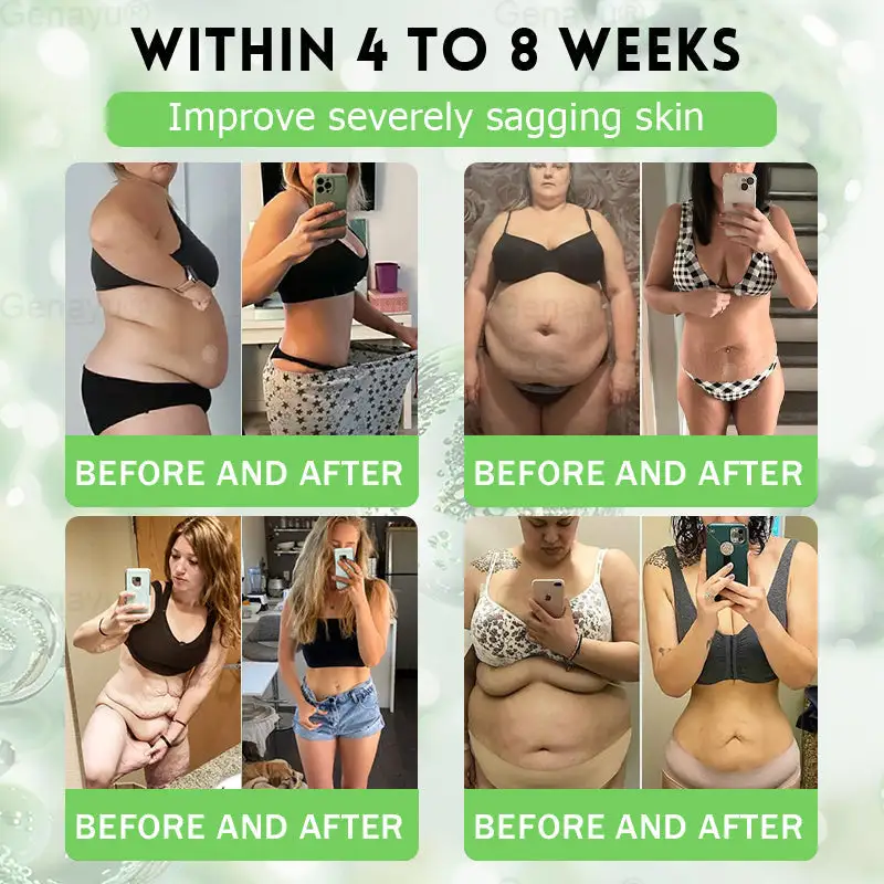 🍃DOTALE® NAD+ Moringa Berberine AMPK Nano Microneedle Patch🍃(Once daily, visible results in 7 days)Supports metabolism, weight management, heart health, and overall wellness💕