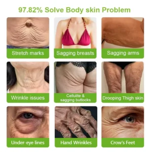 𝑯𝙞𝙨𝙠𝙞𝙣® 🧬𝑷𝑫𝑹𝑵 𝑨𝒏𝒕𝒊-𝑨𝒈𝒊𝒏𝒈 & 𝑻𝒂𝒓𝒈𝒆𝒕𝒆𝒅 𝑺𝒑𝒐𝒕 𝑹𝒆𝒏𝒆𝒘𝒂𝒍 𝑺𝒕𝒊𝒄𝒌（𝑯𝒆𝒍𝒑𝒔 𝑺𝒎𝒐𝒐𝒕𝒉 𝑾𝒓
 – 𝐃𝐎𝐓𝐀𝐋𝐄®