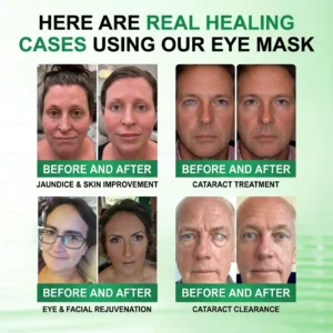 DOTALE® Presbyopia Mask