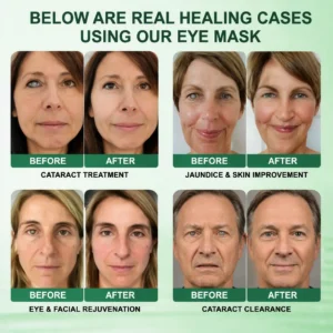 DOTALE® Presbyopia Mask