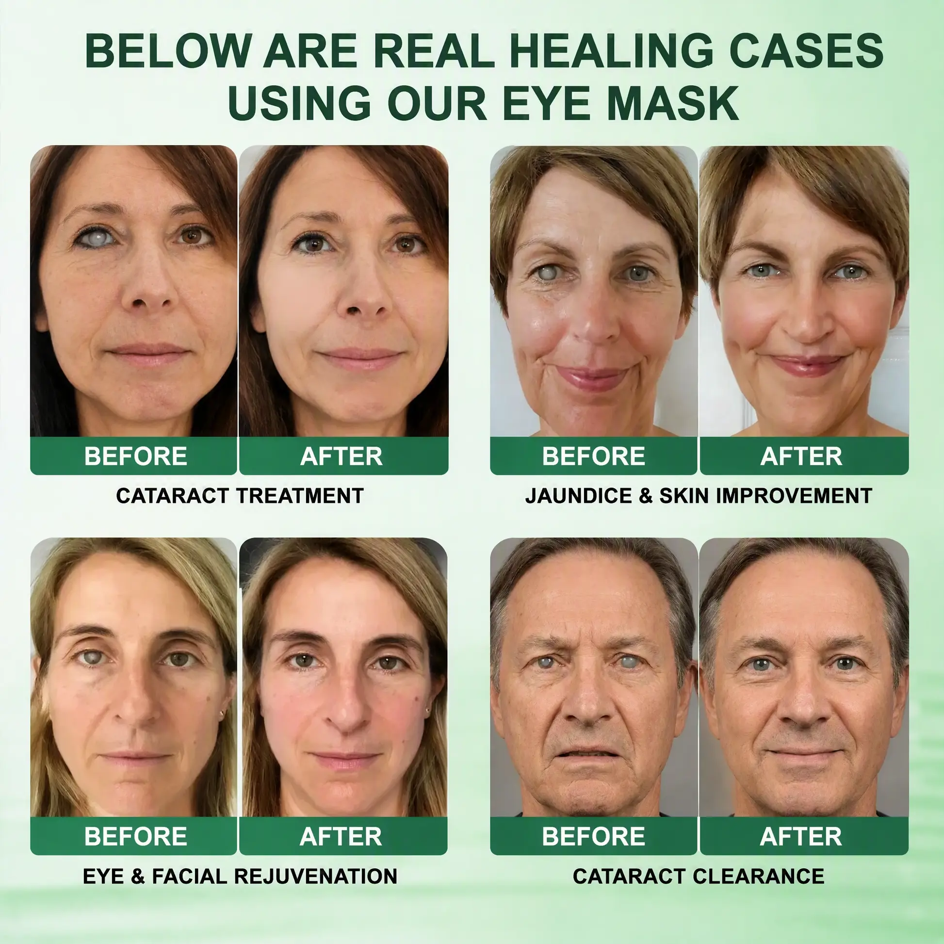 DOTALE® Presbyopia Mask
